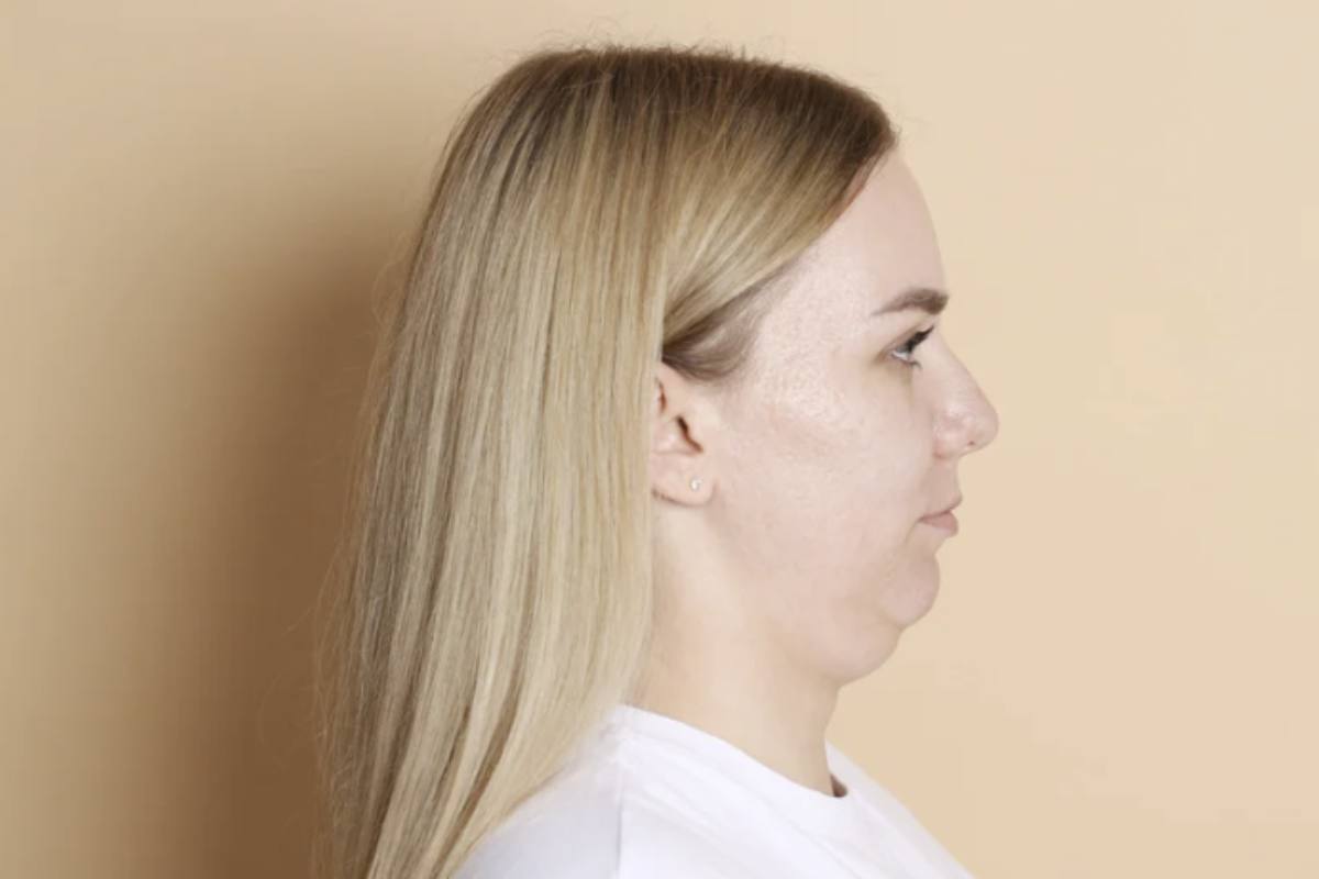 Rivoluziona il tuo profilo: gli esercizi segreti per ridurre il doppio mento e ridefinire il viso 2 Tra gli esercizi più utili per contrastare il doppio mento vi è quello che coinvolge i muscoli digastrici: si punta la lingua verso il naso