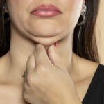 Sebbene non esista una soluzione immediata e miracolosa, oggi è possibile contrastare efficacemente questo problema attraverso specifici esercizi facciali
