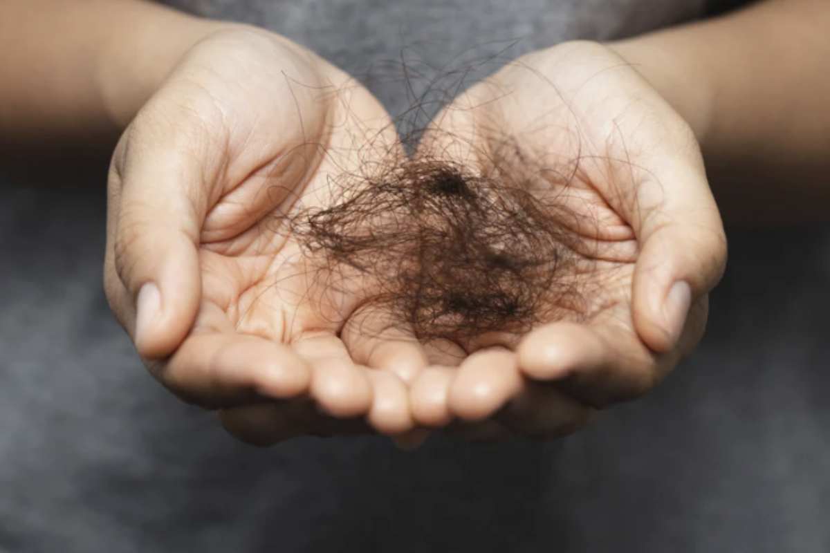 Nonostante i rimedi casalinghi e i cambiamenti di abitudini possano aiutare a migliorare la salute dei capelli, in presenza di una caduta